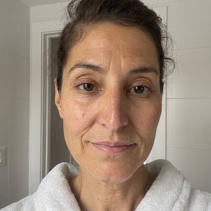 Week 2, fine lines starting to soften
