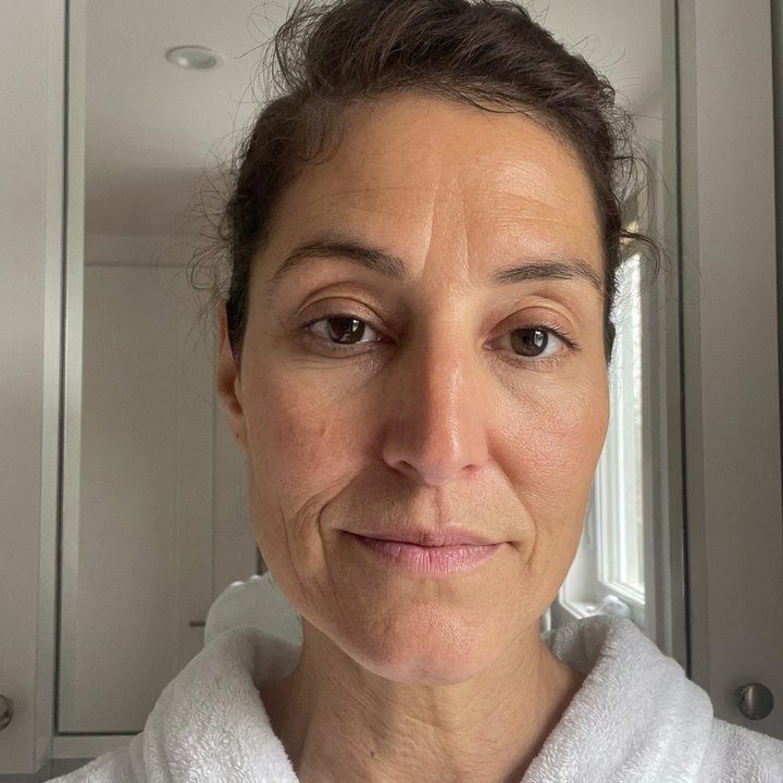 Week 4 to 6, smoother, more even complexion