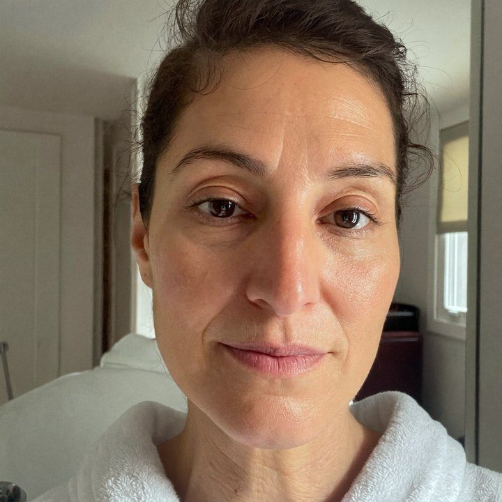 Week 8 to 12, firmer, healthier-looking skin